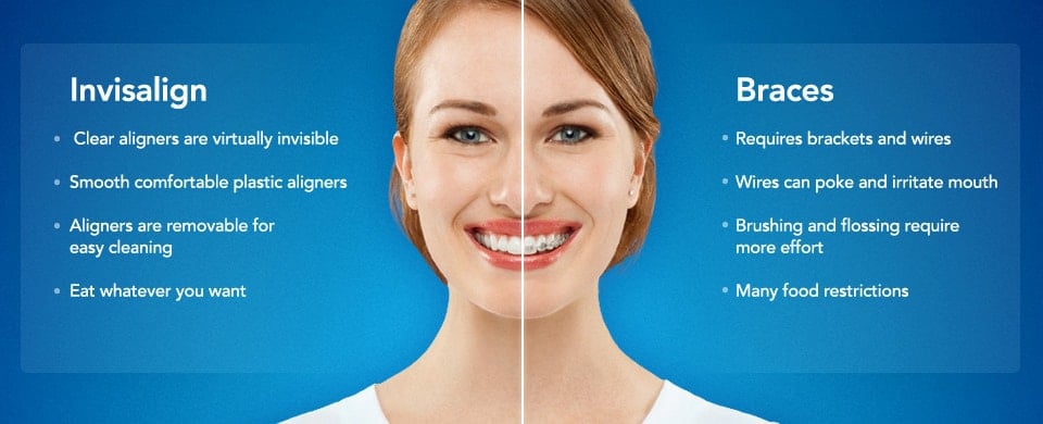 Invisalign Melbourne Book Your Free Invisalign Consultation   Invisalign Treatetment Melbourne 